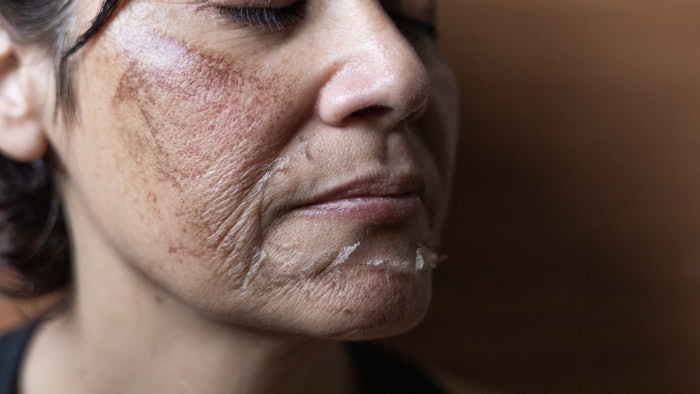 Getty Images 1806618887