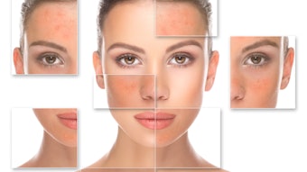 Getty Images 467603823