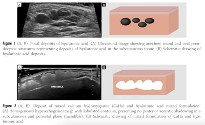 Ultrasound Figures 1,2