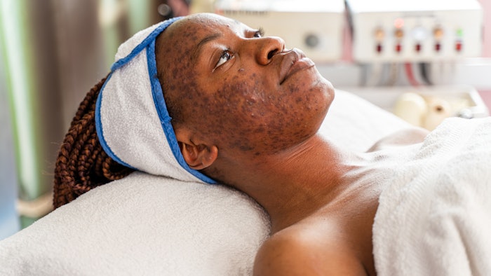 Acne And Rosacea