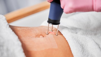 Skincare News Lasers Primaryimage