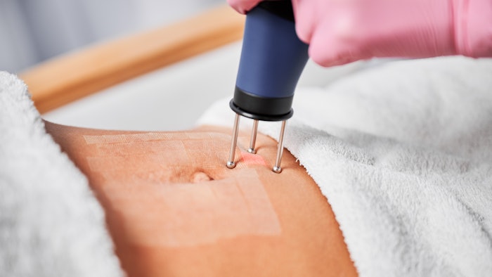 Skincare News Lasers Primaryimage