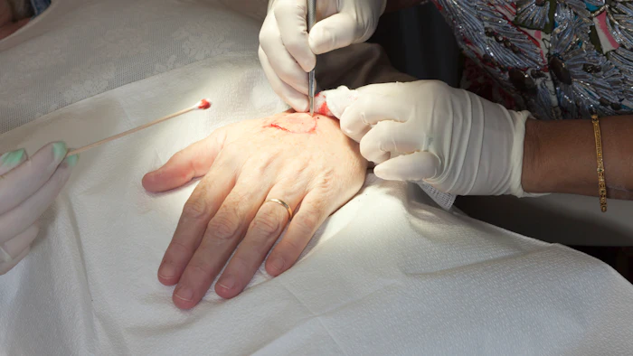 Making a Surgical Incision - Mohs Surgery Technique