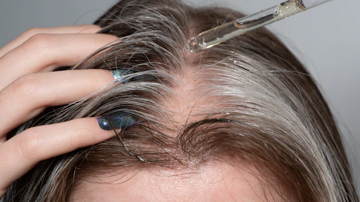 Ia26 Hair Disorders Minoxidil