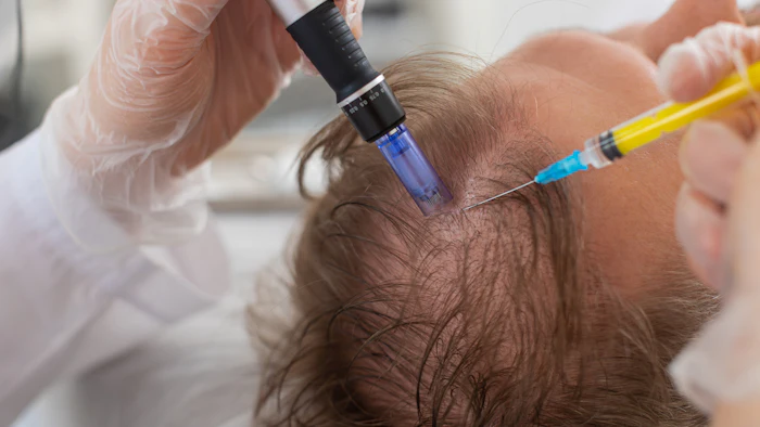 Scn Hair Restoration