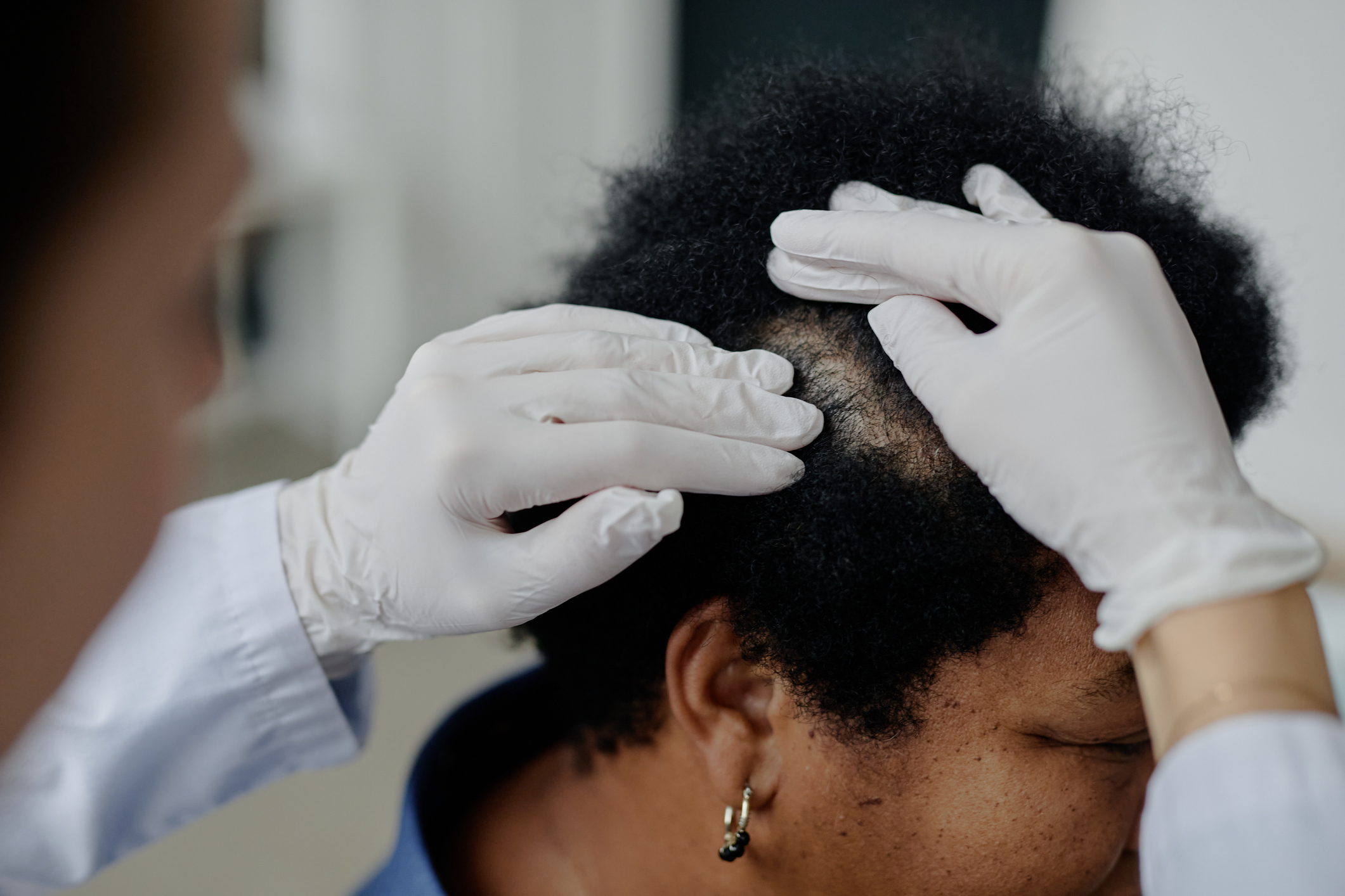 Scn Managing Hair Disorders