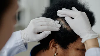 Scn Managing Hair Disorders