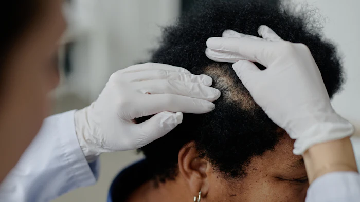 Scn Managing Hair Disorders